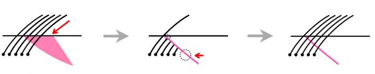 眉下切開_切開方法写真